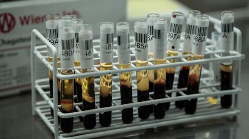 La provincia cubre la necesidad de los pacientes oncológicos desde el Programa Provincial de Hemoterapia