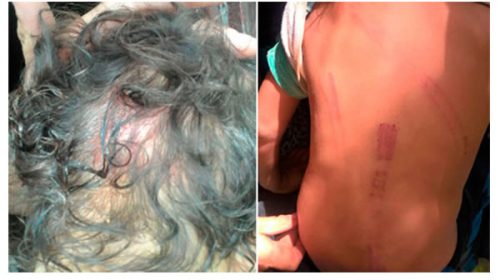 Imputaron a una mujer por torturar a sus hijos menores de seis años