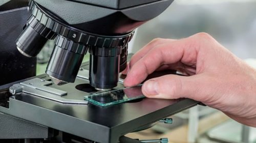 Desarrollan un medicamento para la tuberculosis que beneficiará a más de 20.000 pacientes