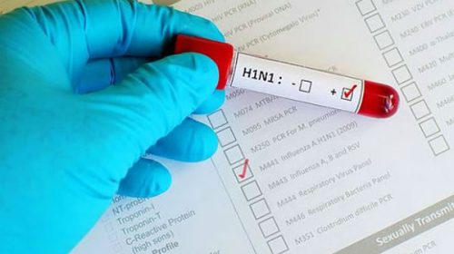 En lo que va del año se han registrado ocho casos de Gripe A en la provincia