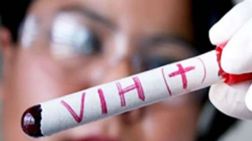 7 noticias sobre el VIH para prestar atención en los próximos años