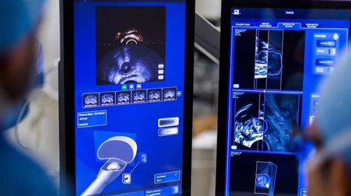 Logran remisión de cáncer de próstata en pacientes avanzados