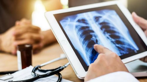 Cáncer: aprobaron en la Argentina dos innovadoras terapias
