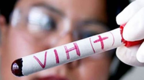 Día Mundial del Sida: una nueva vacuna y fármacos de acción prolongada, las esperanzas a futuro