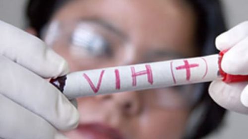 Avance en VIH con bases argentinas: presentan esquema de tratamiento con sólo dos drogas