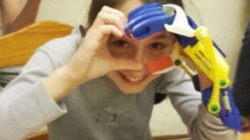 Dos niñas entrerrianas recibieron en forma gratuita prótesis impresas en 3D