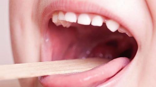 Crece la preocupación por el streptococcus