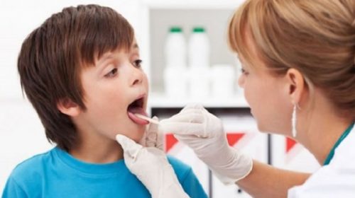 Streptococcus: “Es una bacteria conocida y su tratamiento es muy sencillo”