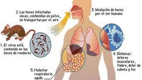 Hantavirus: ¿qué es, cómo se contagia y cómo se previene?
